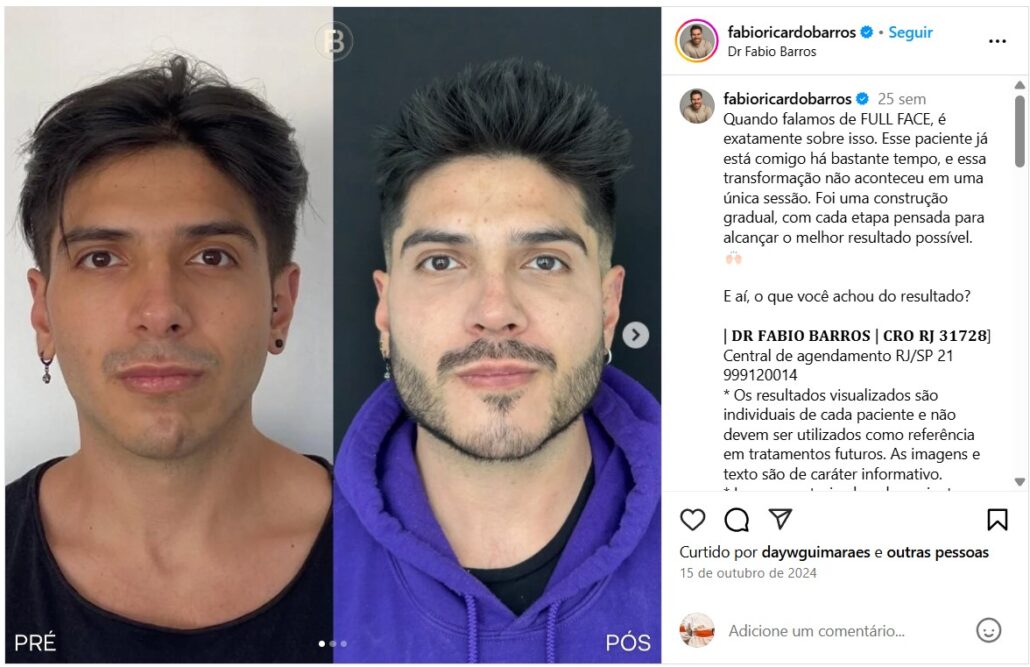instagram - Dr Fabio Barros