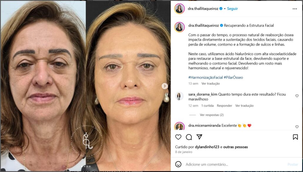 instagram - Dra Thallita Pereira Queiroz